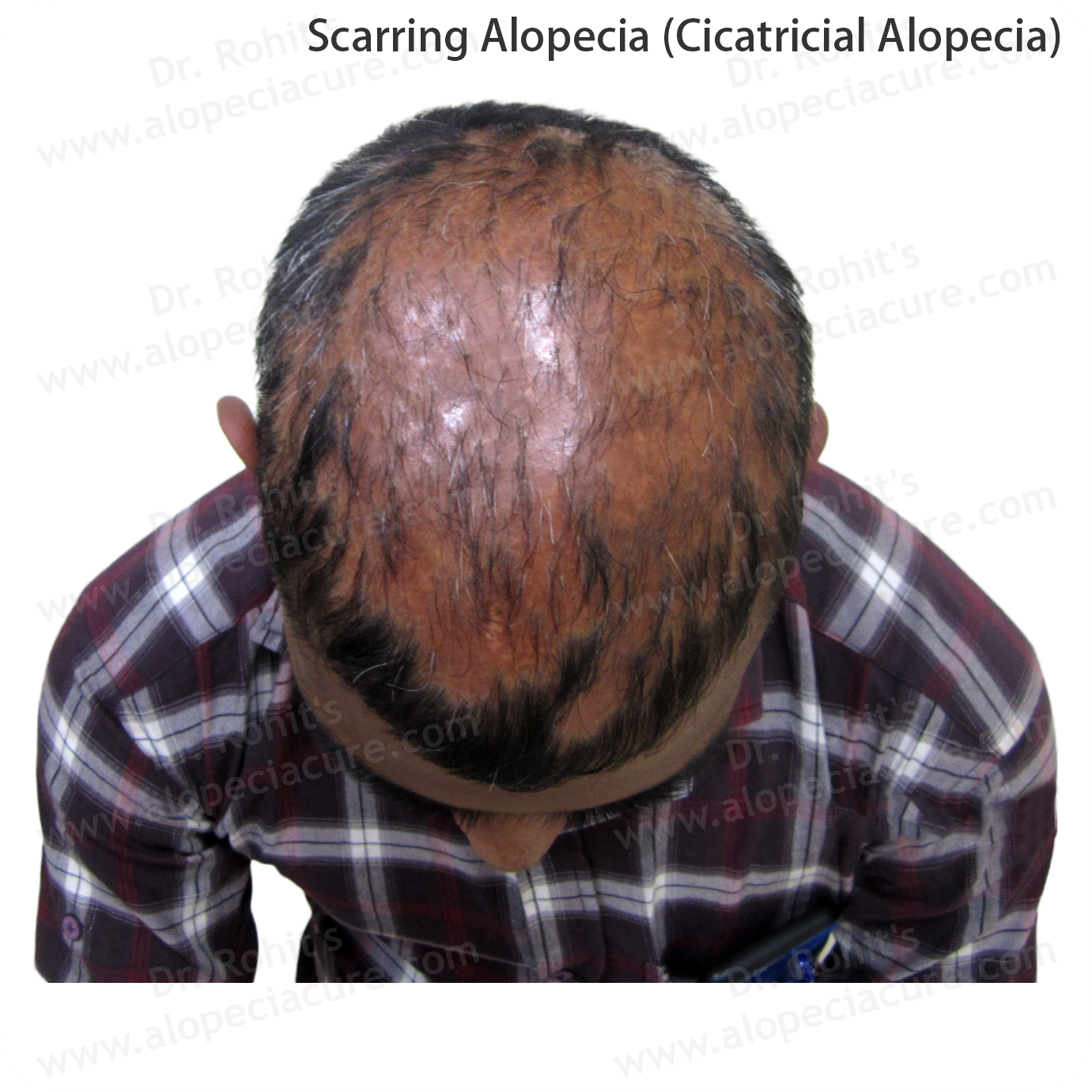 Clinical Hair Treatment